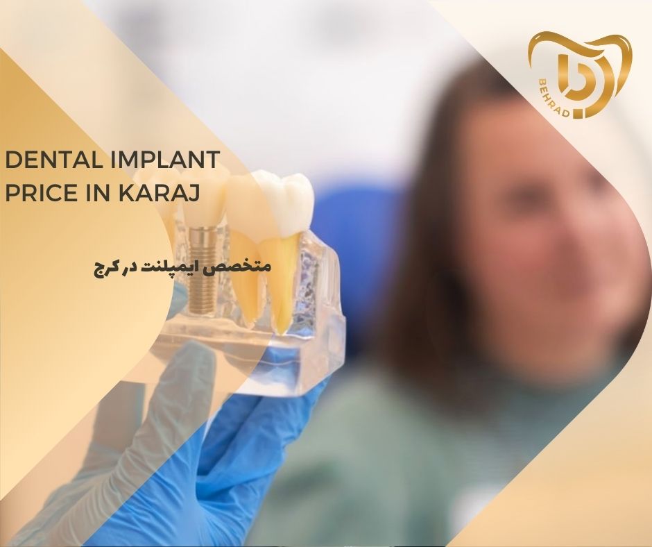 behrad-404-08-08 متخصص ایمپلنت در کرج