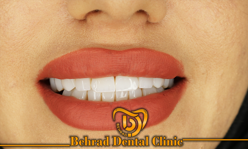 دندانپزشک خوب و منصف در کرج