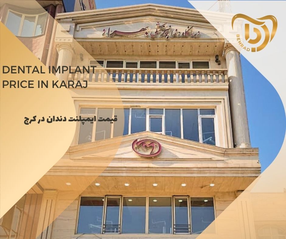 behrad-404-07-10 قیمت ایمپلنت دندان در کرج