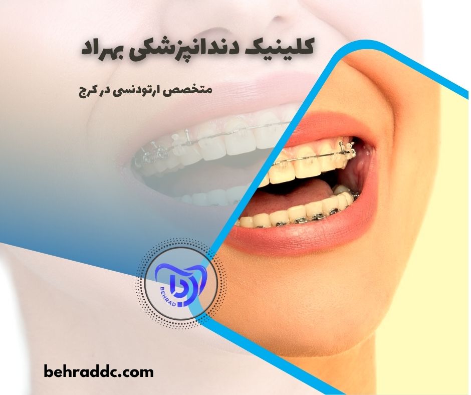 متخصص ارتودنسی در کرج