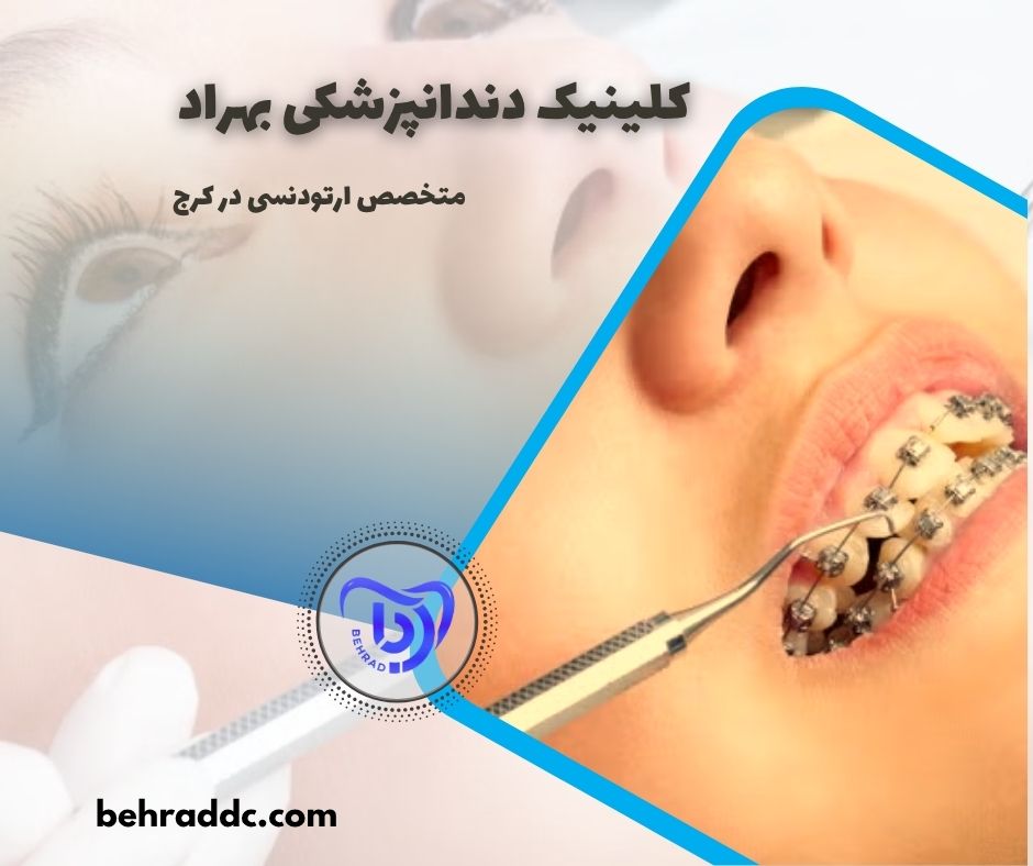 متخصص ارتودنسی در کرج