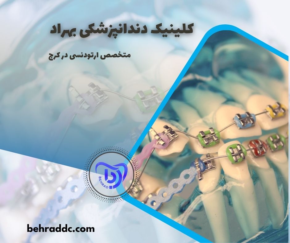 متخصص ارتودنسی در کرج