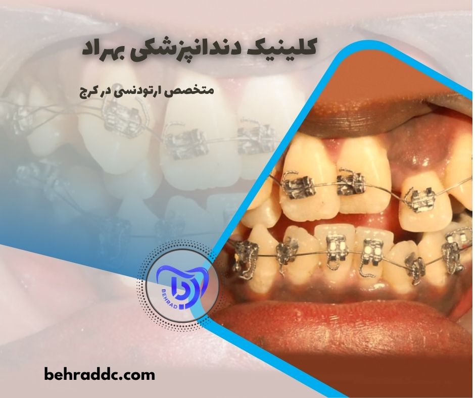 behrad-404-08-06 متخصص ارتودنسی در کرج